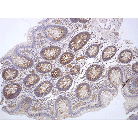 MUC1 Recombinant monoclonal antibody (SM3) (Mouse IgG1lambda) Immunohistochemistry
