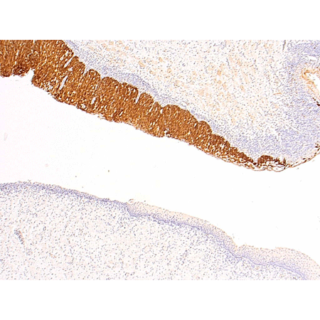 p16INK4a monoclonal antibody (Ready-to-Use) Immunohistochemistry