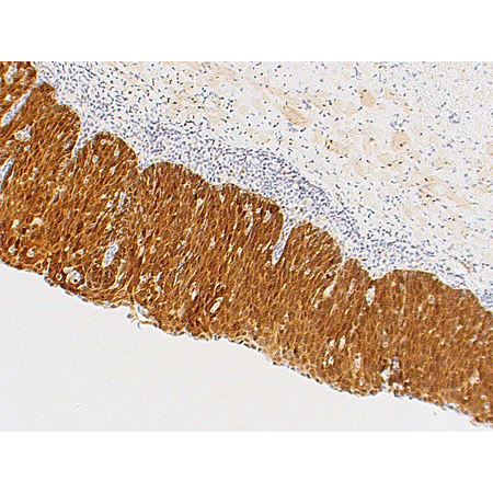p16INK4a monoclonal antibody (Ready-to-Use) Immunohistochemistry