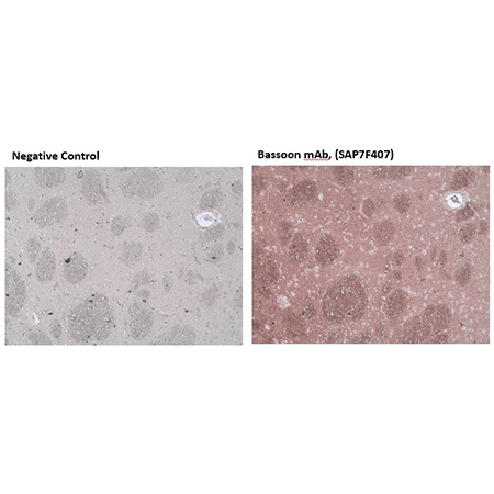 Bassoon monoclonal antibody (SAP7F407) Immunohistochemistry