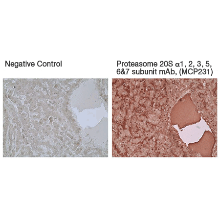 Proteasome 20S α1, 2, 3, 5, 6 & 7 subunits monoclonal antibody (MCP231) Immunohistochemistry