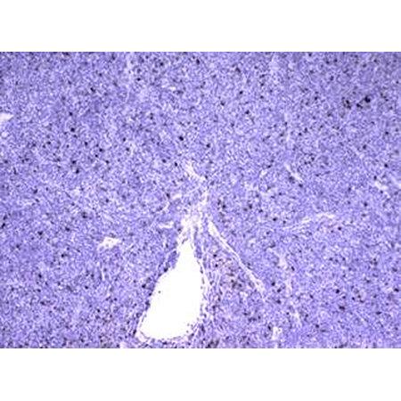 LAG-3 (human) recombinant monoclonal antibody (L4-PL33) Immunohistochemistry