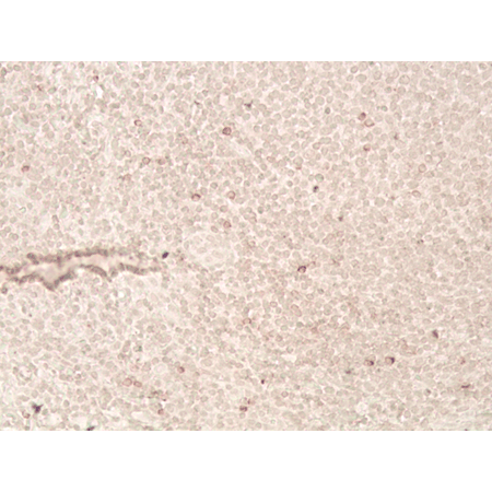 LAG-3 (human) recombinant monoclonal antibody (L4-PL33) Immunohistochemistry