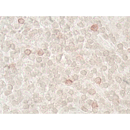 LAG-3 (human) recombinant monoclonal antibody (L4-PL33) Immunohistochemistry