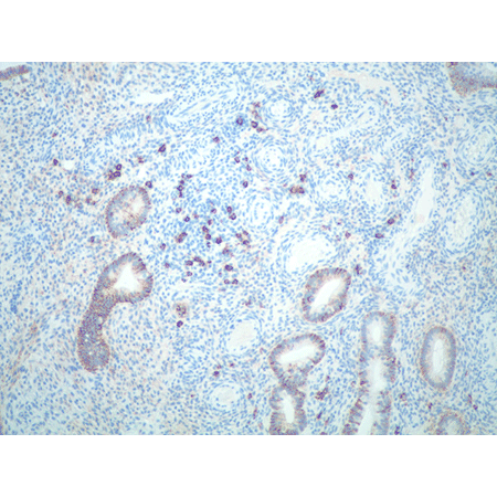 CD138 monoclonal antibody Immunohistochemistry
