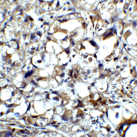 CTLA4 monoclonal antibody (1E6) Immunohistochemistry