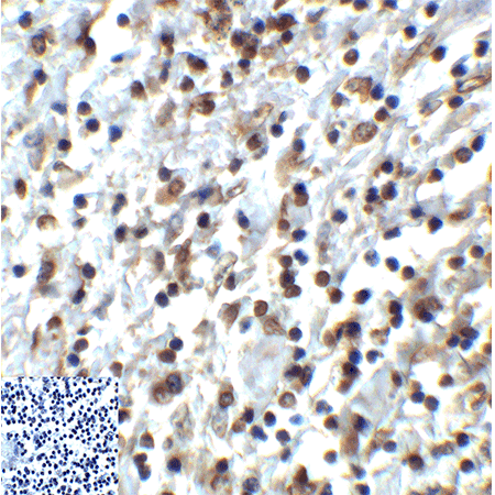 TIGIT monoclonal antibody (4A12) Immunohistochemistry