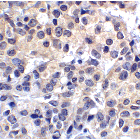 VISTA monoclonal antibody (4C4) Immunohistochemistry