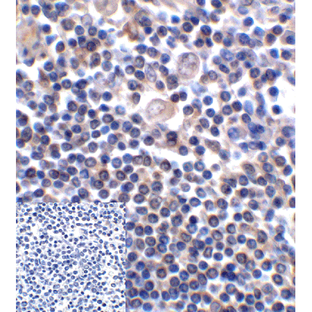 B7-H3 monoclonal antibody (2A7) Immunohistochemistry