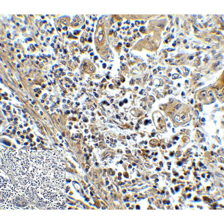 TIM-3 monoclonal antibody (1B10) Immunohistochemistry