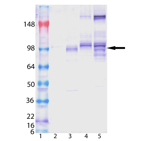 Insulin receptor β monoclonal antibody (C18C4) Western blot