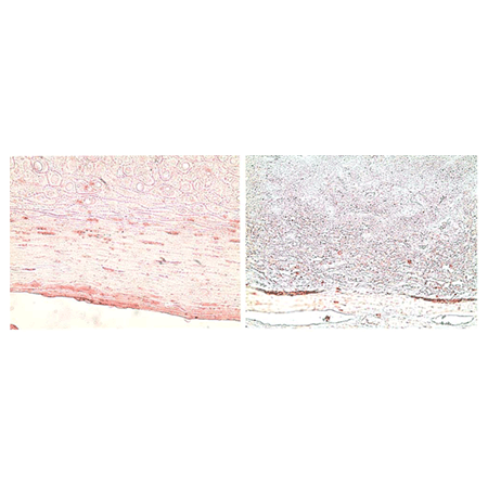 Survivin monoclonal antibody (60.11) Immunohistochemistry