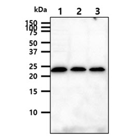 CD94 monoclonal antibody (AT13E3) Western Blot
