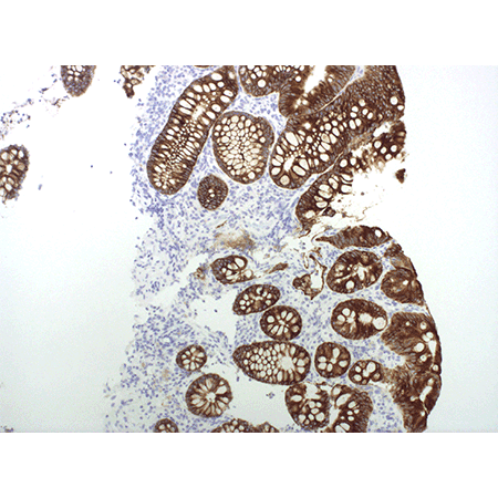 MUC4 monoclonal antibody (Ready-to-Use) Immunohistochemistry Human Colon