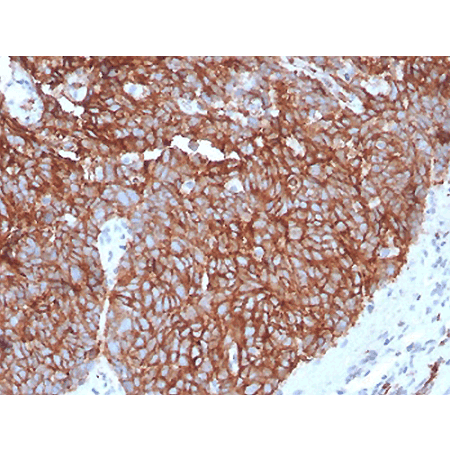 GLUT1 Recombinant monoclonal antibody (3132R) Immunohistochemistry