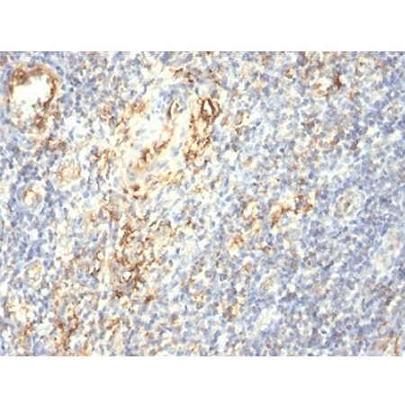 Transglutaminase 2 monoclonal antibody (419) Immunohistochemistry tonsil