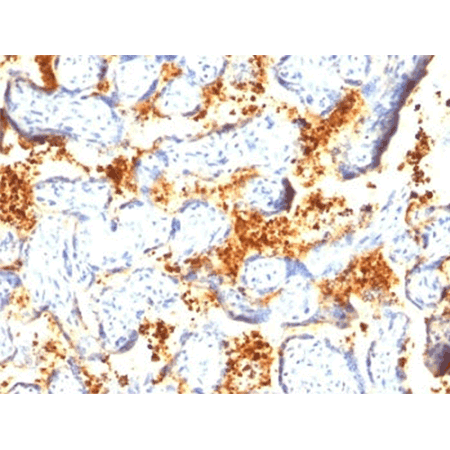 Transglutaminase 2 monoclonal antibody (419) Immunohistochemistry placenta