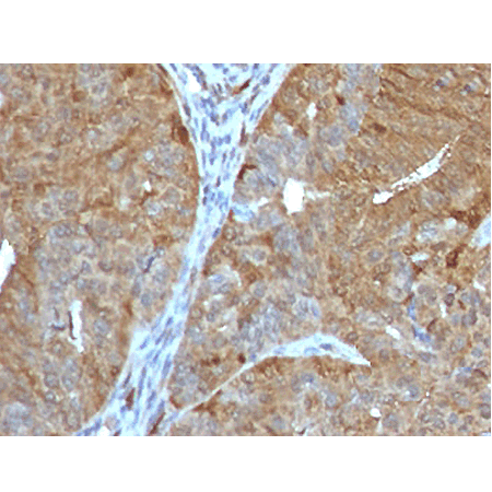 Aldose reductase monoclonal antibody (ADRD1-1) Immunohistochemistry