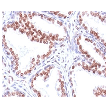 Androgen receptor monoclonal antibody (SPM335) Immunohistochemistry