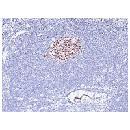 Bcl6 monoclonal antibody (SPM602) Immunohistochemistry