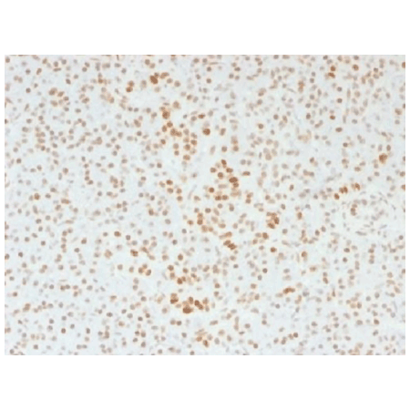 PAX7 monoclonal antibody (PBPX7) Immunohistochemistry