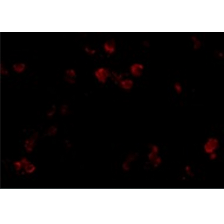 CD81 polyclonal antibody Immunofluorescence