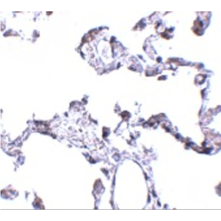 CD81 polyclonal antibody Immunohistochemistry
