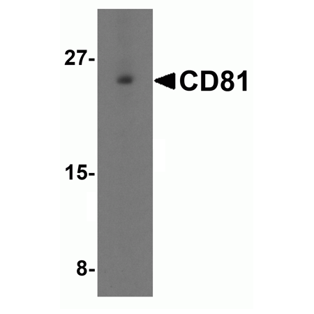 CD81 polyclonal antibody Western Blot