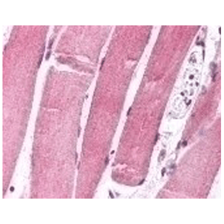 FOXO1 monoclonal antibody (7h3) Immunohistochemistry
