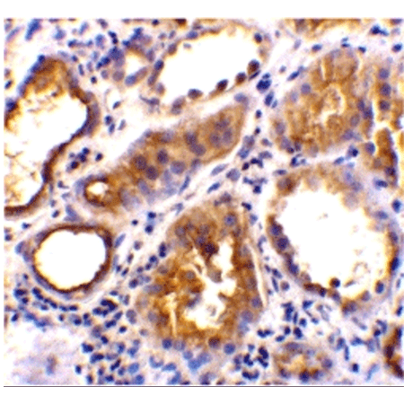ACE2 polyclonal antibody Immunohistochemistry