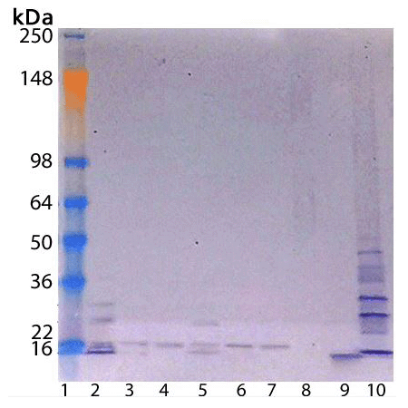 Polyubiquitinylated conjugates recombinant monoclonal antibody (UBQM) Western blot