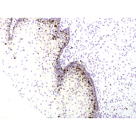 SAVIEW® PLUS HRP reagent Immunohistochemistry