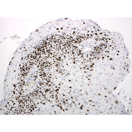 POLYVIEW® PLUS HRP (anti-rabbit) reagent Immunohistochemistry