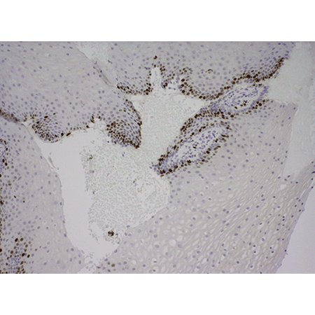 POLYVIEW® PLUS HRP (anti-rabbit) reagent Immunohistochemistry