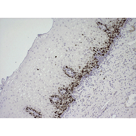 POLYVIEW® PLUS HRP (anti-rabbit) reagent Immunohistochemistry