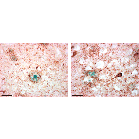 POLYVIEW® PLUS HRP (anti-mouse) reagent Immunohistochemistry ADbrain b-amyloid-p-tau