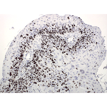 POLYVIEW® PLUS HRP (anti-mouse) reagent Immunohistochemistry