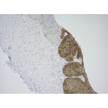 POLYVIEW® PLUS HRP (anti-mouse) reagent Immunohistochemistry