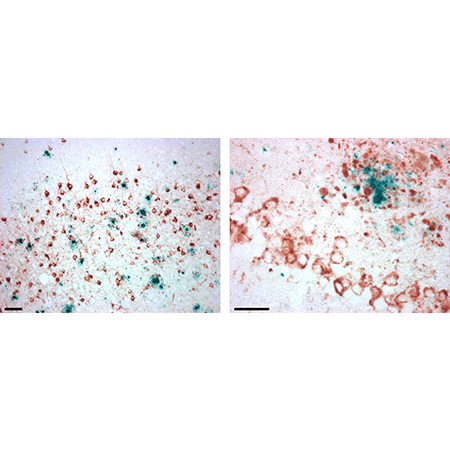 POLYVIEW PLUS HRP (anti-mouse) reagent Immunohistochemistry Mousebrain b-amyloid-p-tau