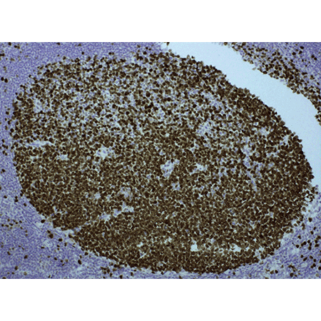 POLYVIEW PLUS HRP (anti-mouse) reagent Immunohistochemistry tonsil tissue