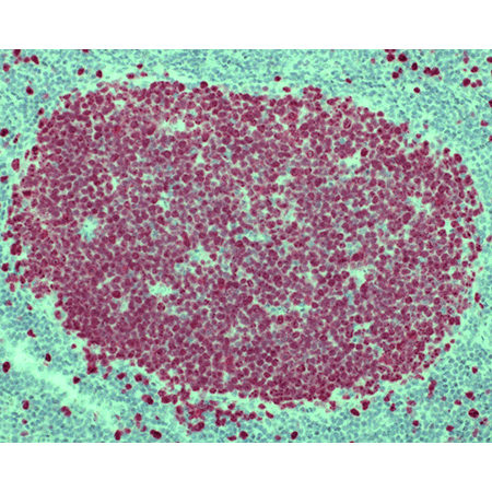 POLYVIEW PLUS AP (anti-rabbit) reagent Immunohistochemistry tonsil tissue