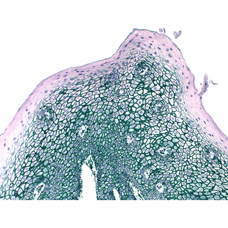 SAVIEW® PLUS AP Reagent Immunohistochemistry