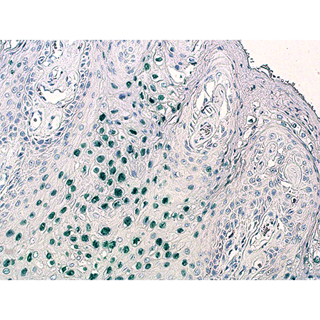 SAVIEW® PLUS AP Reagent 2