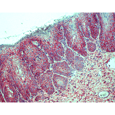 POLYVIEW® PLUS AP (anti-mouse) reagent 2