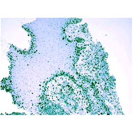 HIGHDEF Green AP Chromogen/Substrate Immunohistochemistry cervical tissue Ki-67