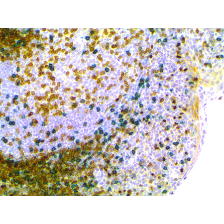 HIGHDEF Green AP Chromogen/Substrate IHC human tonsil multiplex