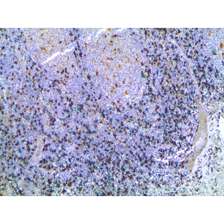 HIGHDEF Green AP Chromogen/Substrate IHC human tonsil multiplex 2