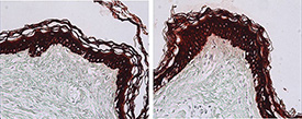 Cytokeratin 1/5/10/14 (human) monoclonal antibody (34βE12) Immunohistochemistry