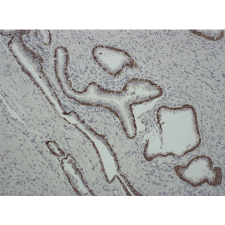 Cytokeratin 1/5/10/14 (human) monoclonal antibody (34βE12) Immunohistochemistry