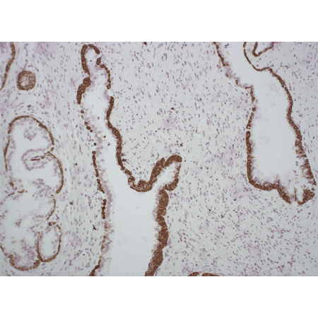 Cytokeratin 1/5/10/14 (human) monoclonal antibody (34βE12) Immunohistochemistry
